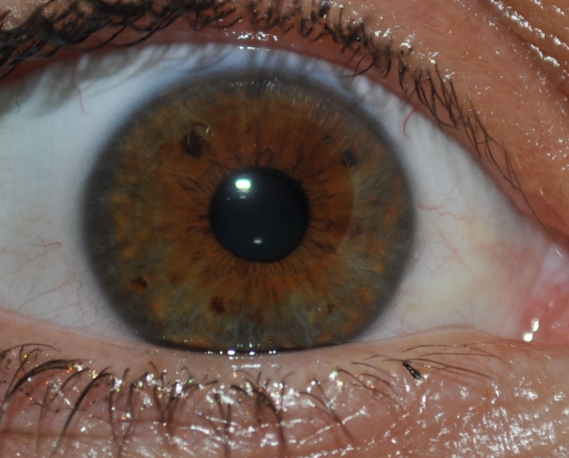 Photo d'oeil